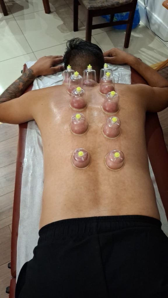 ertified Hijama Training Course in the UK