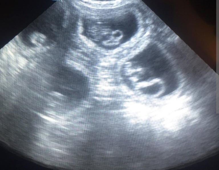 image for Pet ultrasound scan 