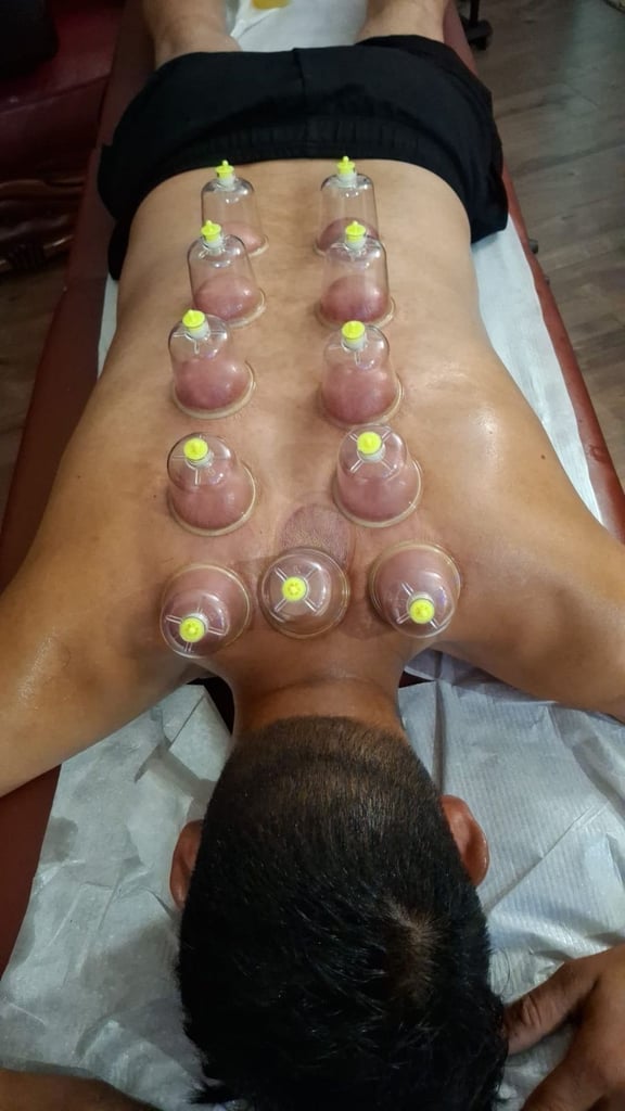 image for ertified Hijama Training Course in the UK