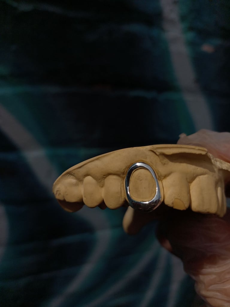 Custom made single cap window grillz 