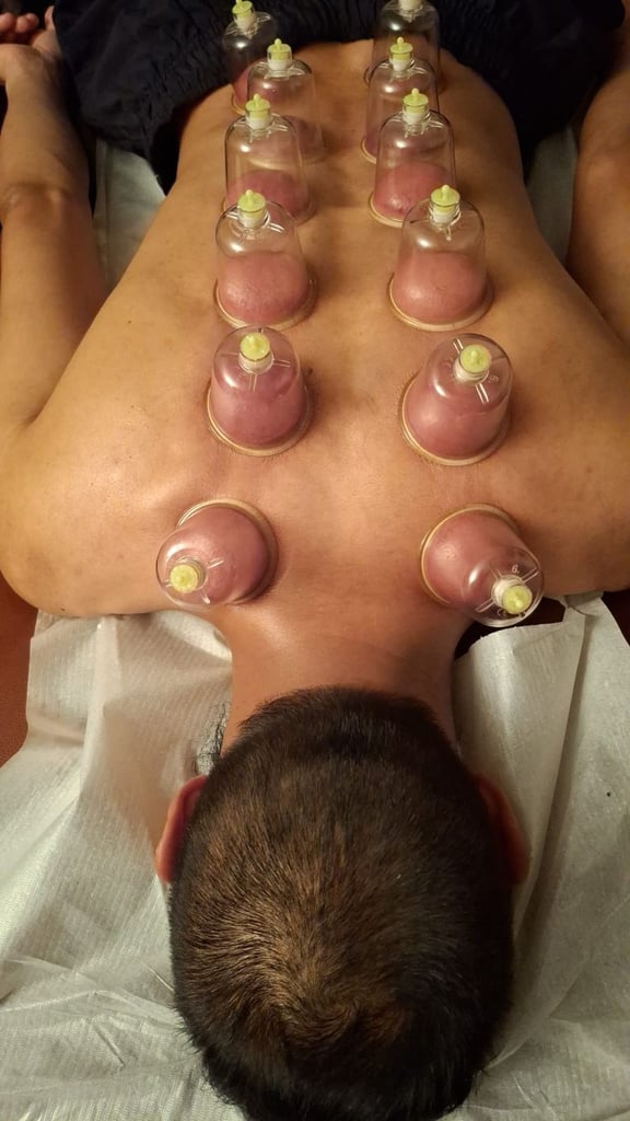 Become a Certified Hijama Therapist – Hijama Cupping Course UK