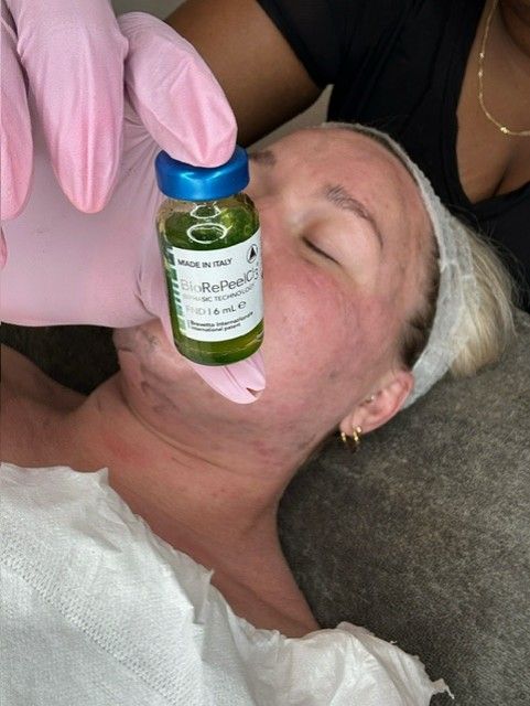 facial, hydration facial, dermaplane facial, mothers glow facial services 