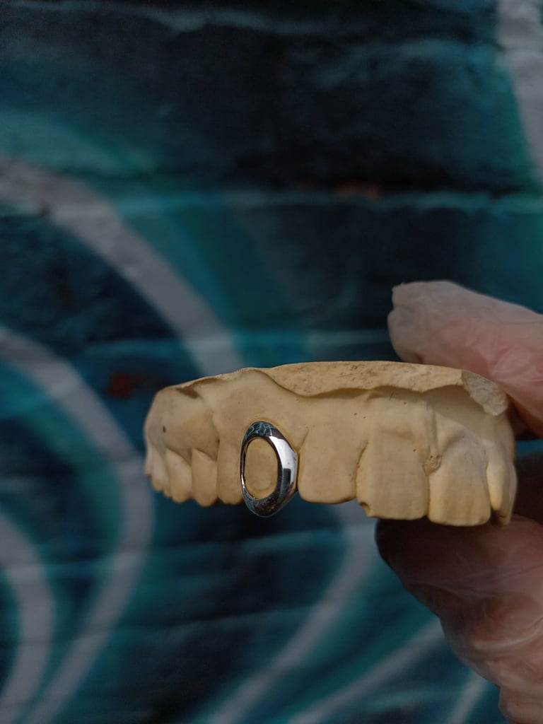 Custom made single cap window grillz 