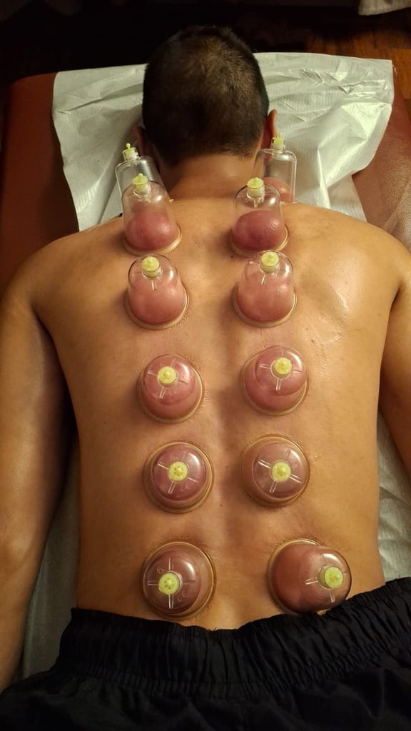Become a Certified Hijama Therapist – Hijama Cupping Course UK