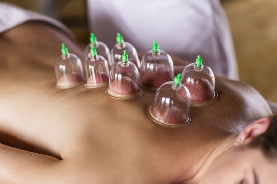 image for Mobile Cupping/Hijama therapist