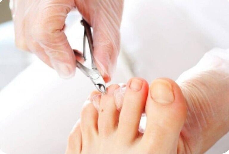 PEDICURES in Derby AND OTHER TREATMENTS 