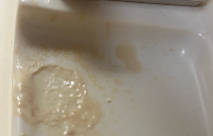 Melted stain on bathroom sink