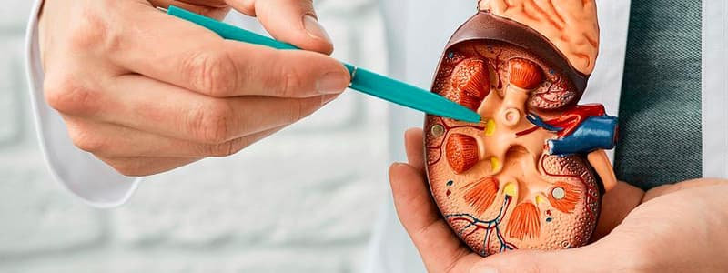 Piedras en el Riñón: Síntomas, Tratamiento y Cirugía de Excelencia en Hospital CMQ