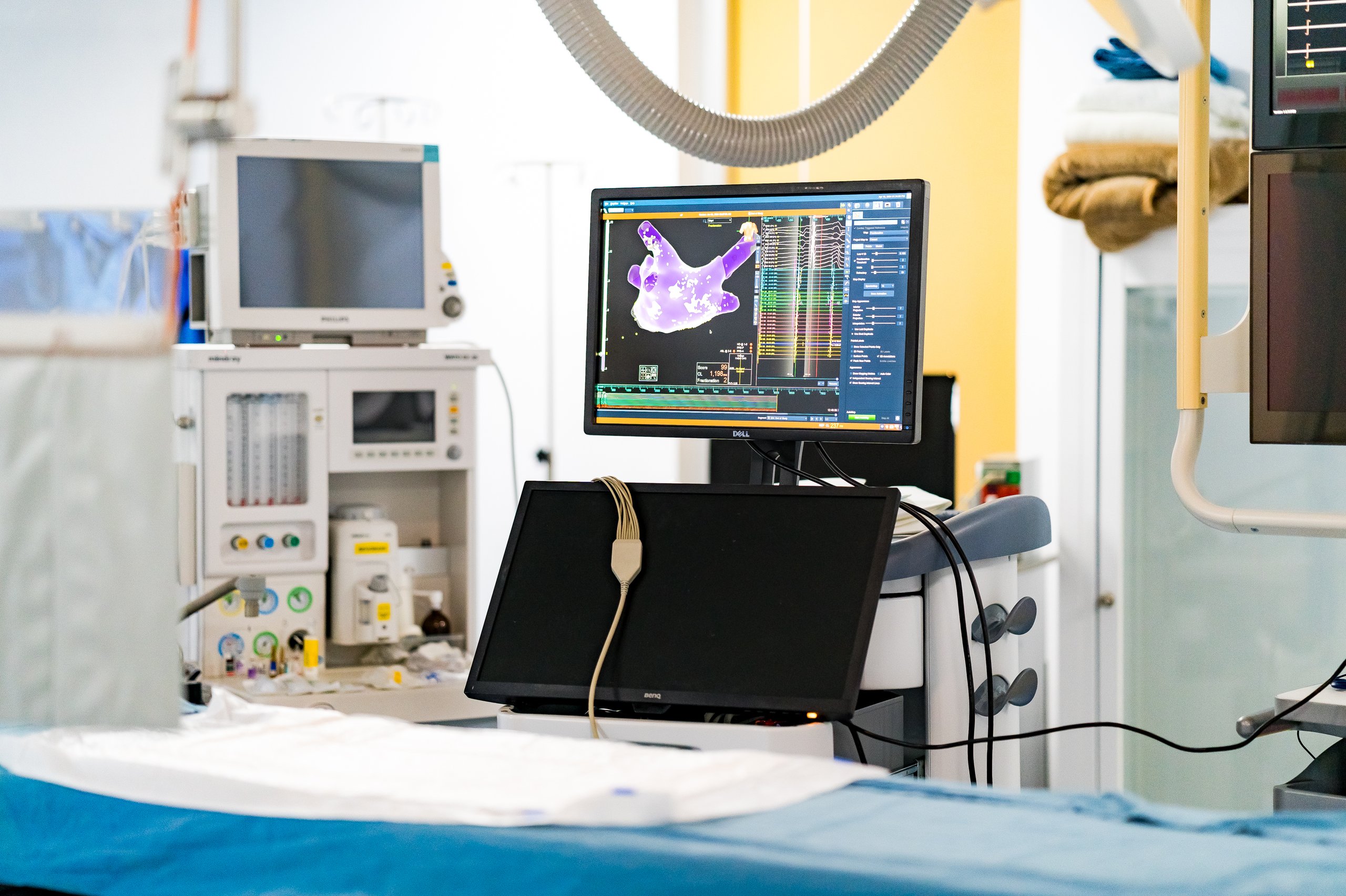 EnSite Velocity Cardiac Mapping System de Abbot Cardiovascular