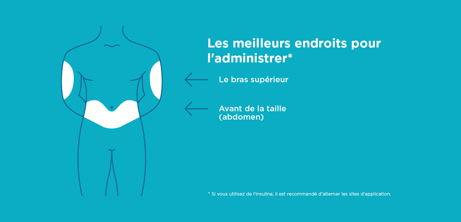 Les meilleurs endroits pour l'administrer