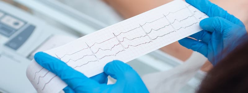 Electrocardiograma anormal