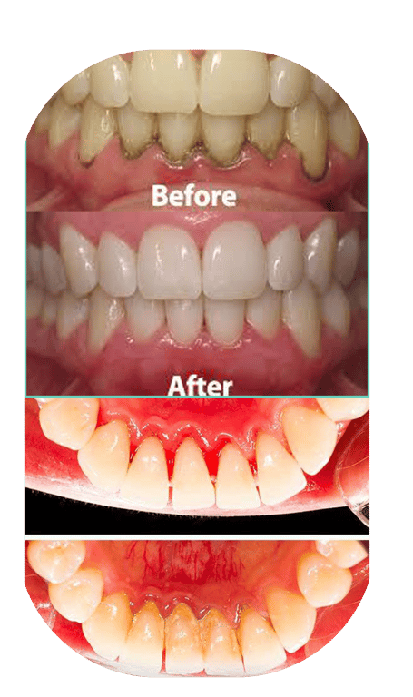 treatment-content-image-1