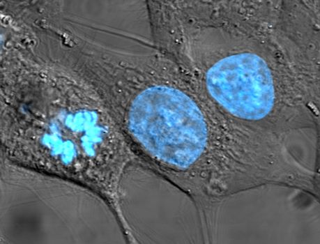 প্রাণ ও বিবর্তন । আদনান শাহরিয়ার 29 HeLa_cells_stained_with_Hoechst_33258.jpg