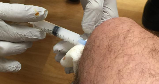 Knee shot