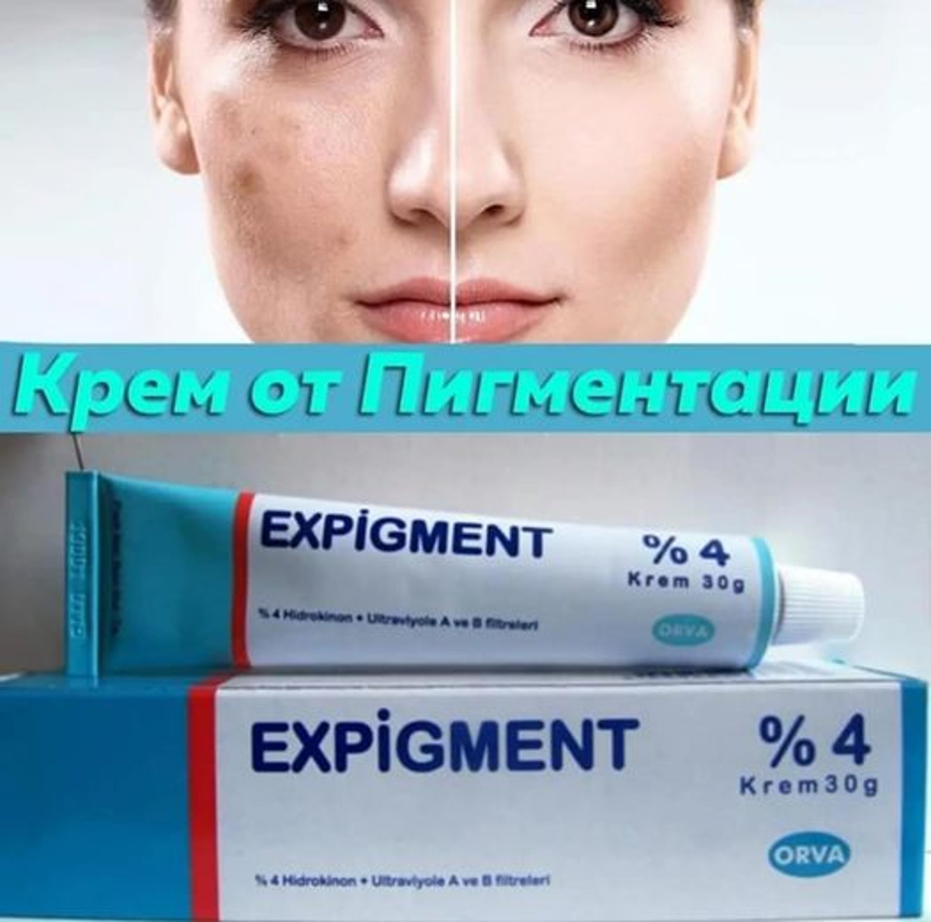 Expigment 4% / Експигмент Избелващ крем за лунички и петна