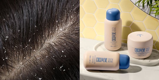 Image of scalp with dandruff and Coco & Eve Honey Bliss Hair Set