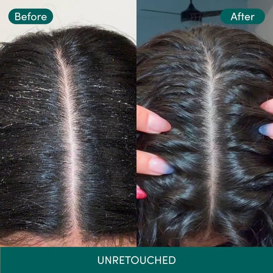 Product card 2nd image of Clarifying Detox Shampoo