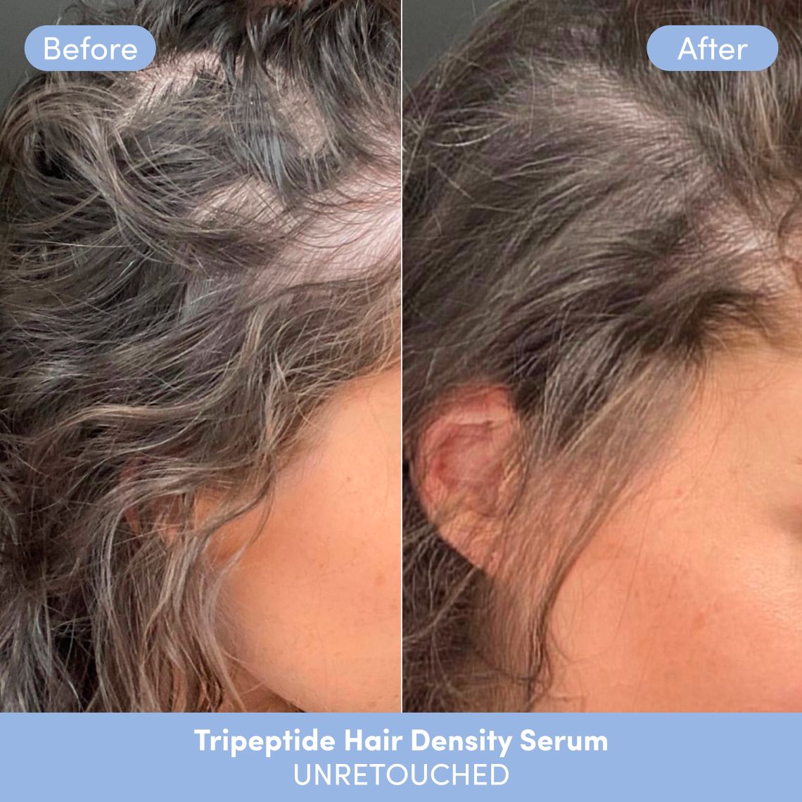 Product card 2nd image of Bounce & Boost Hair Set