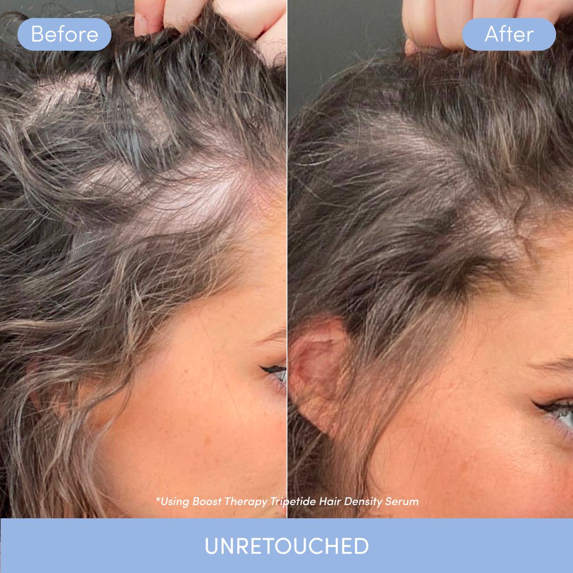 Product card 2nd image of Tripeptide Hair Density Serum