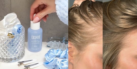 Image of Coco & Eve Tripeptide Hair Density Serum on the left and image of scalp before and after using Coco & Eve Tripeptide Hair Density Serum