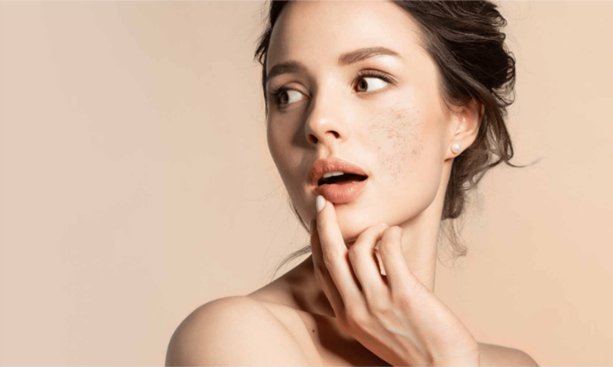 With a systematic plan and procedure, pores and scars become smoother