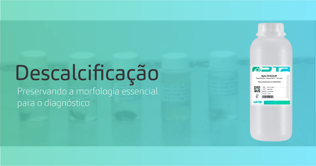 A Importância de um Descalcificador de Qualidade no Processamento de Biópsias Ósseas para Microtomia