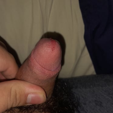 This juicy dick pic shows a thick cock with dark pubic hair.