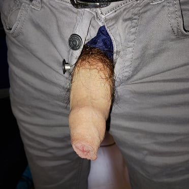 A beautiful, hairy dick pic showing a thick, uncut cock peeking out from grey pants.