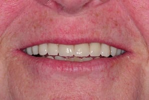 Hermon Family Dental 