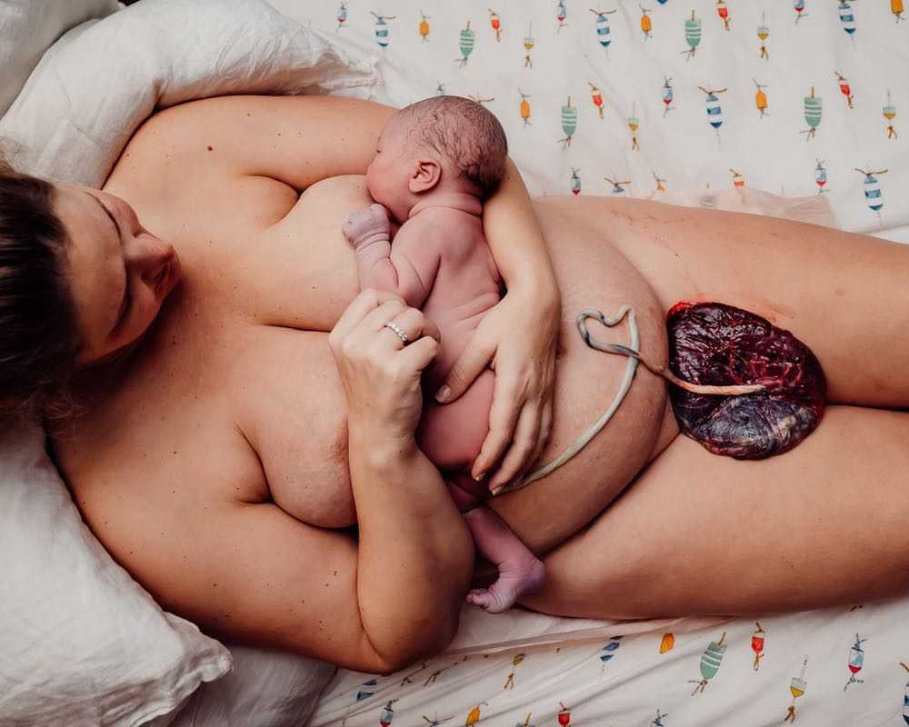 Baby laying on mother after birth attached to placents