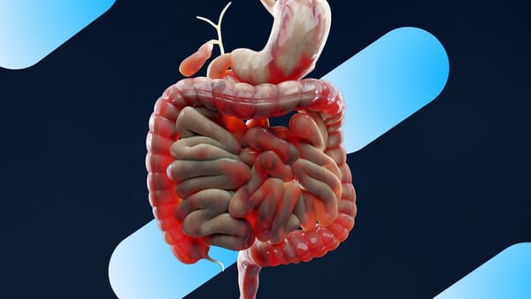 Illustration of the gut microbiome comparing dysbiosis and SIBO