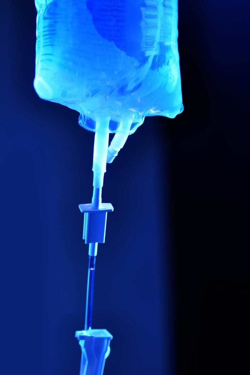 Ultraviolet Blood Irradiation (UBI) therapy