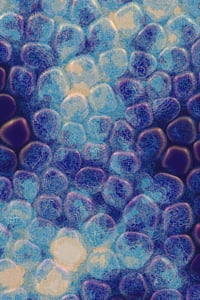 Vitreous #2 thumbnail