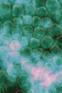 Vitreous #9 thumbnail