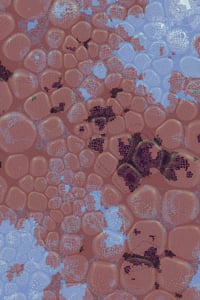 Vitreous #3 thumbnail