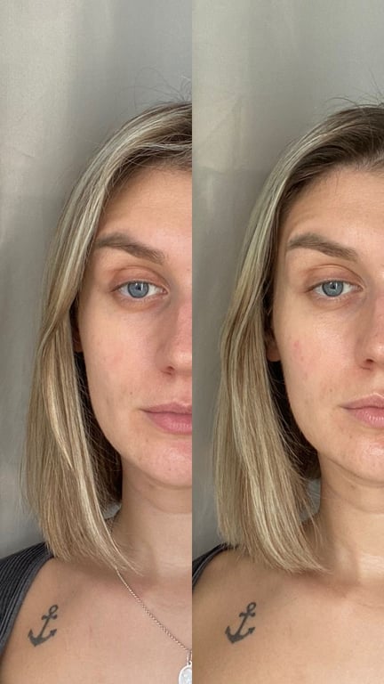 Client before and after result 1