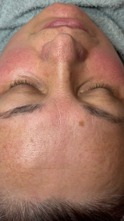 Client after photo 3
