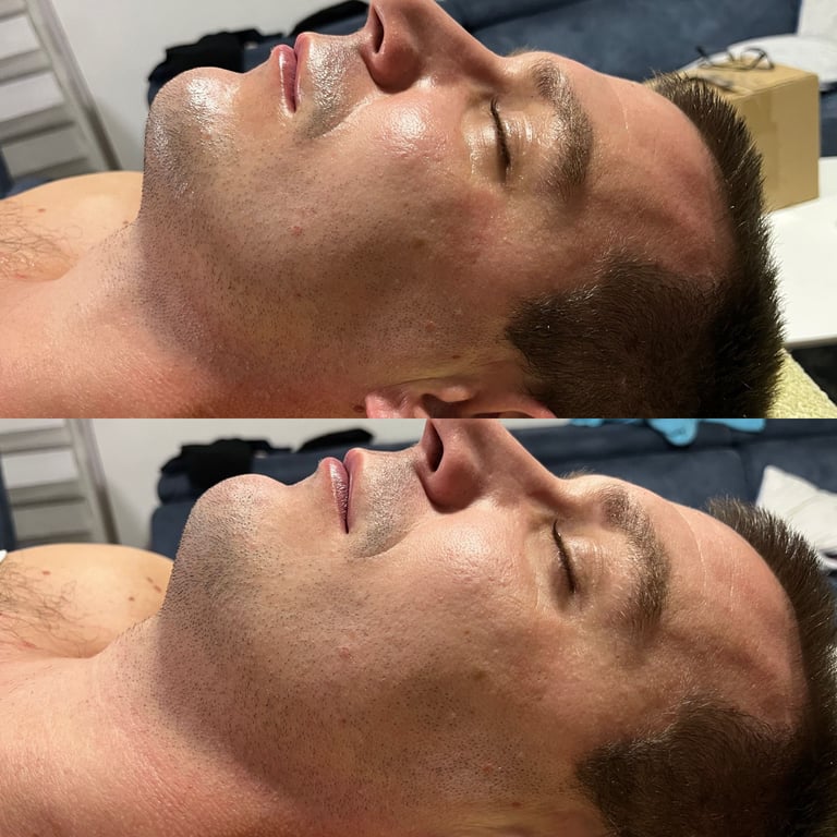 Client before and after result 2