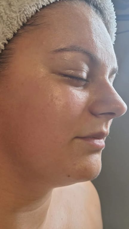 Client after photo 2