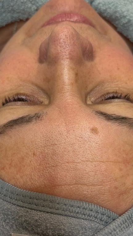 Client before photo 3