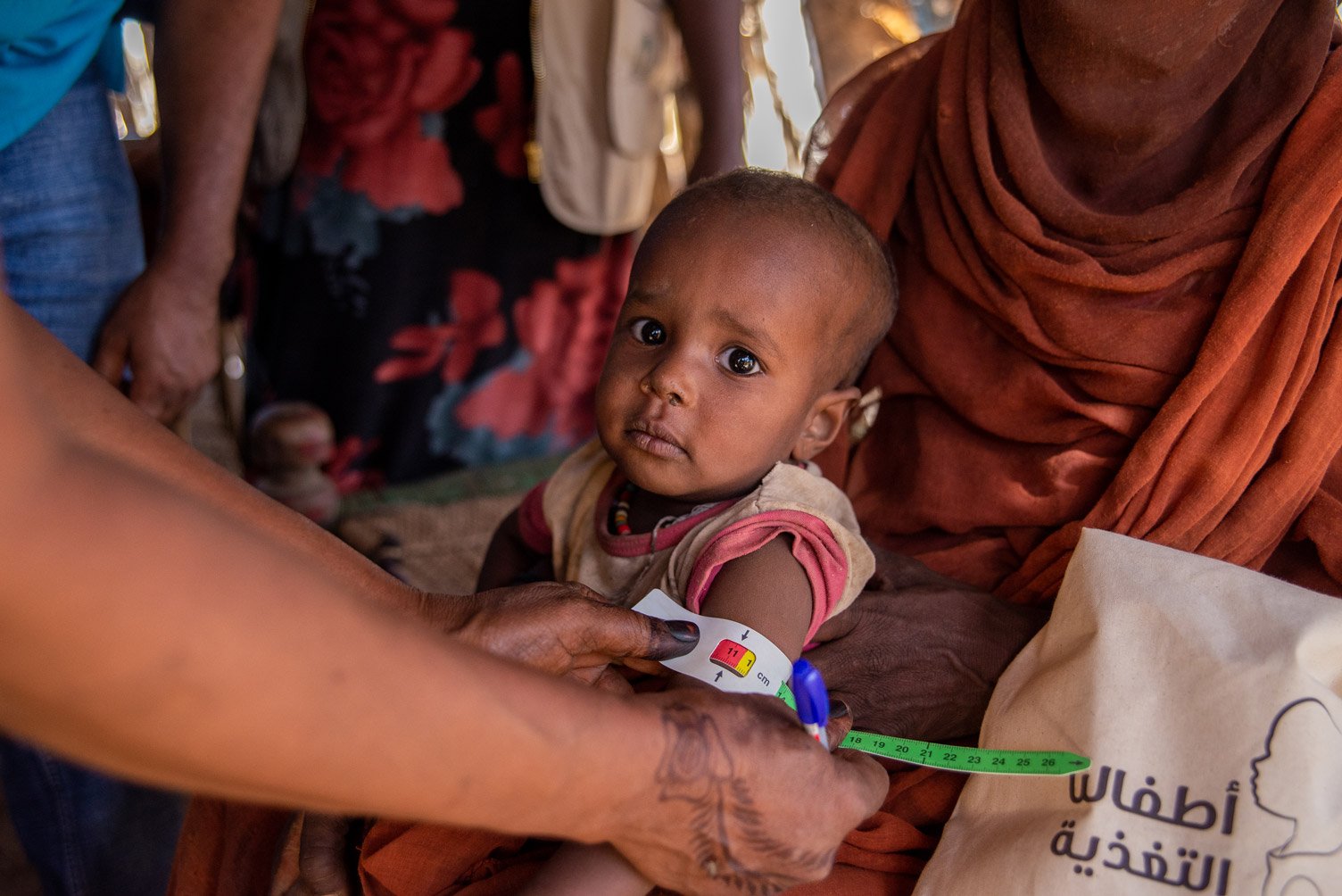 Im Rahmen einer von UNICEF unterstützten Ernährungskampagne werden Kinder in Kassala im Sudan auf Mangelernährung untersucht.