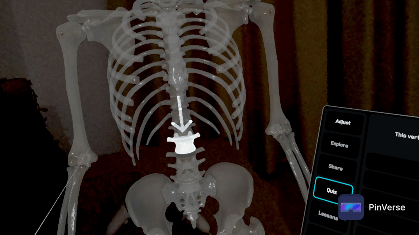 Anatomy X — Quiz, screen 1 of 6