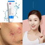 كريم الوجه بالجاليكوليك اسيد ايبيو