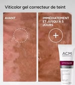 جل ACM Viticolor لتمويه البشرة 50مل