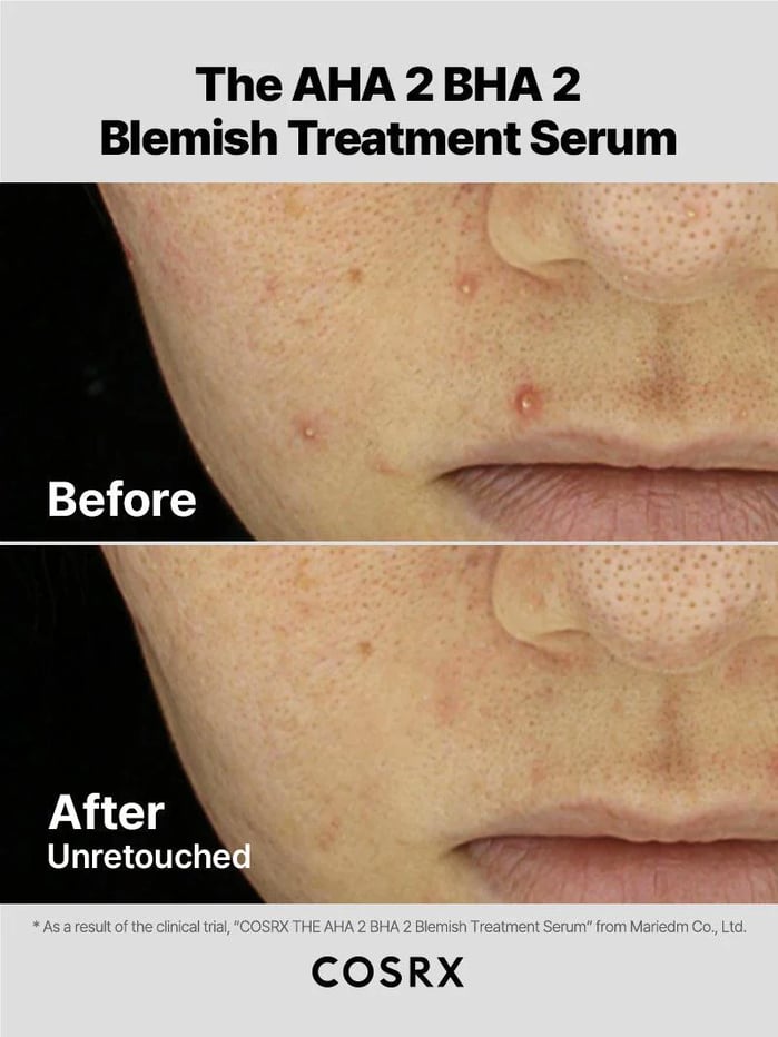 AHA2BHA2 Blemish 03 2