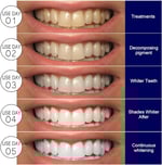 ايهلو شرائط تبييض الاسنان 7 شرائط EELHOE Teeth Whitening Strips