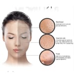 بيورديرم قناع الفحم للتنظيف العميق بفقاعات الاكسجين 1 قناع Purederm Deep Cleansing Black O2 Bubble Mask