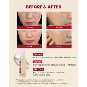 كي سيكرت سيروم سيول 1988 بخلاصة موسين الحلزون 97٪ + الأرز 100مل K Secret Seoul 1988 Serum Essence Snail Mucin 97% + Rice