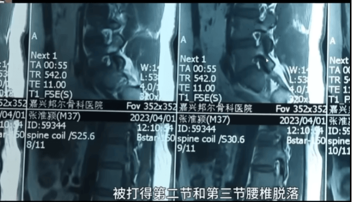 7ded8368f5dc3f8650bbd58b36827068db11d0