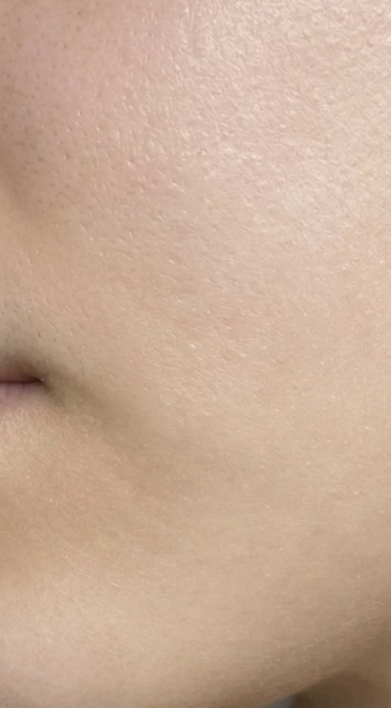 [잡담] 내 피부 한번 봐줘 ㅎㅎ1년동안 관리해서 여드름 싹 없앳다 | 인스티즈